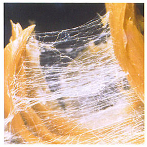 Fascie web